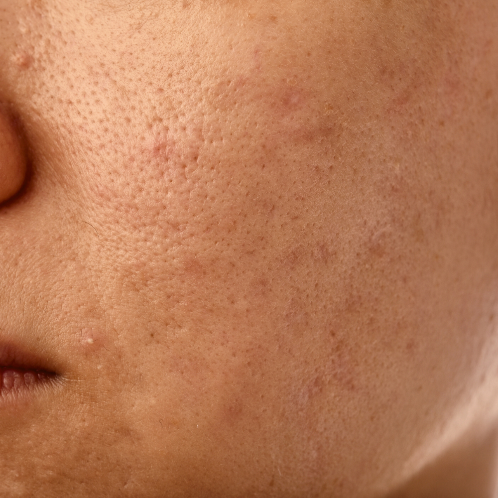 Dull_Skin_a0ed8c54-91b7-4504-a52e-a049f95dbf2c.png