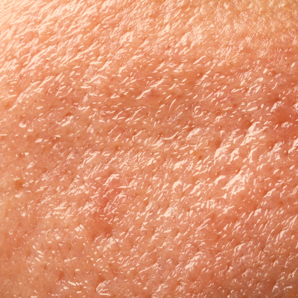 Textured_Skin_fe6246a9-31e0-4e6b-8636-5068dfc871bb.png