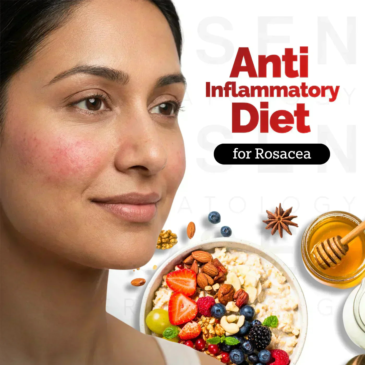 How Your Diet Impacts Rosacea: Science Backed Tips on What to Eat and Avoid