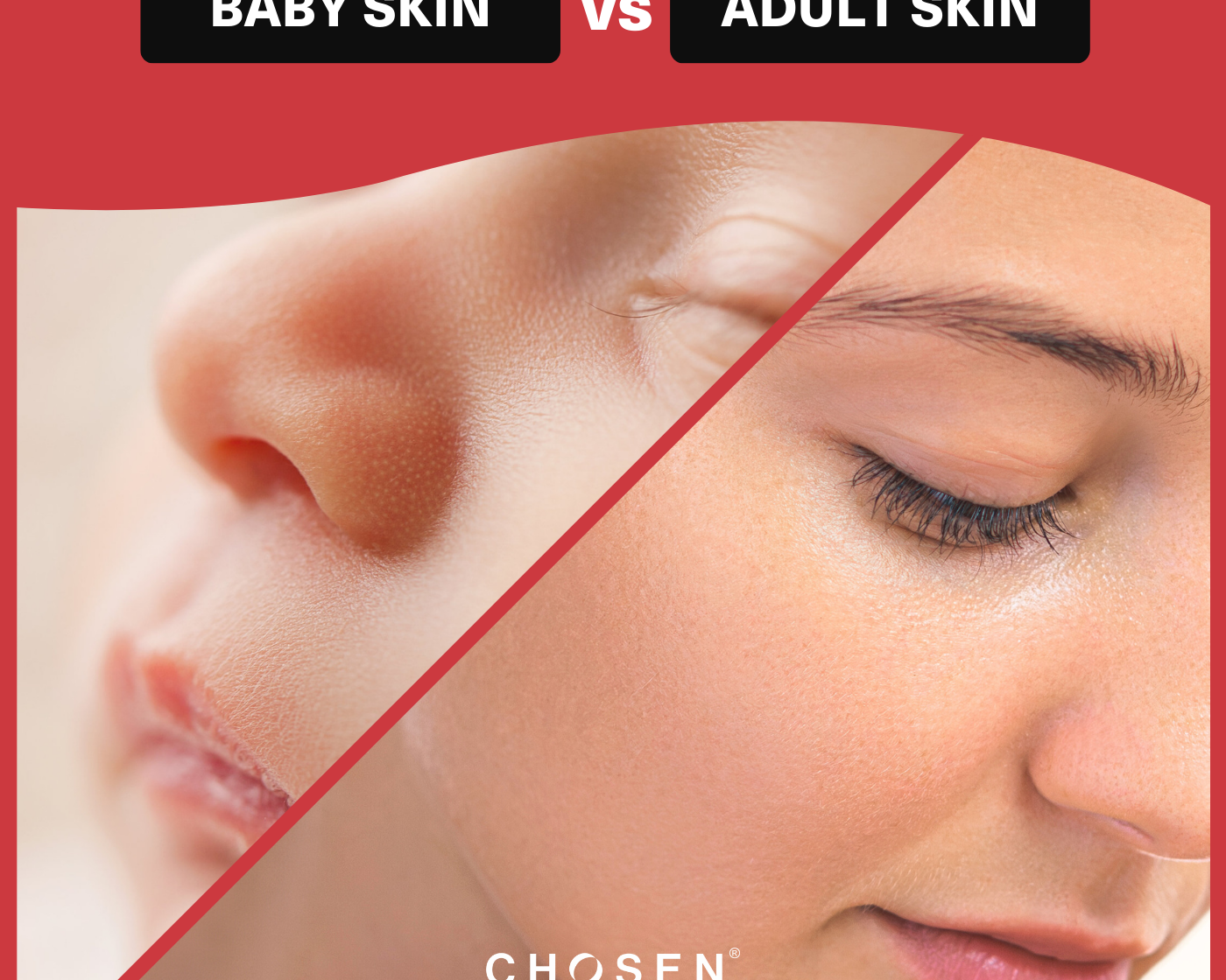 How is baby skin different from adult skin?