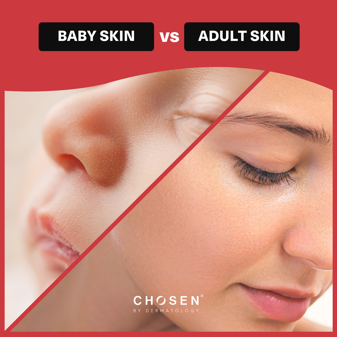 How is baby skin different from adult skin?
