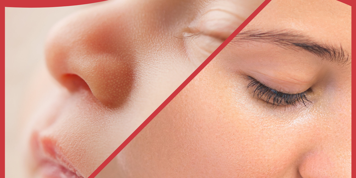 How is baby skin different from adult skin?