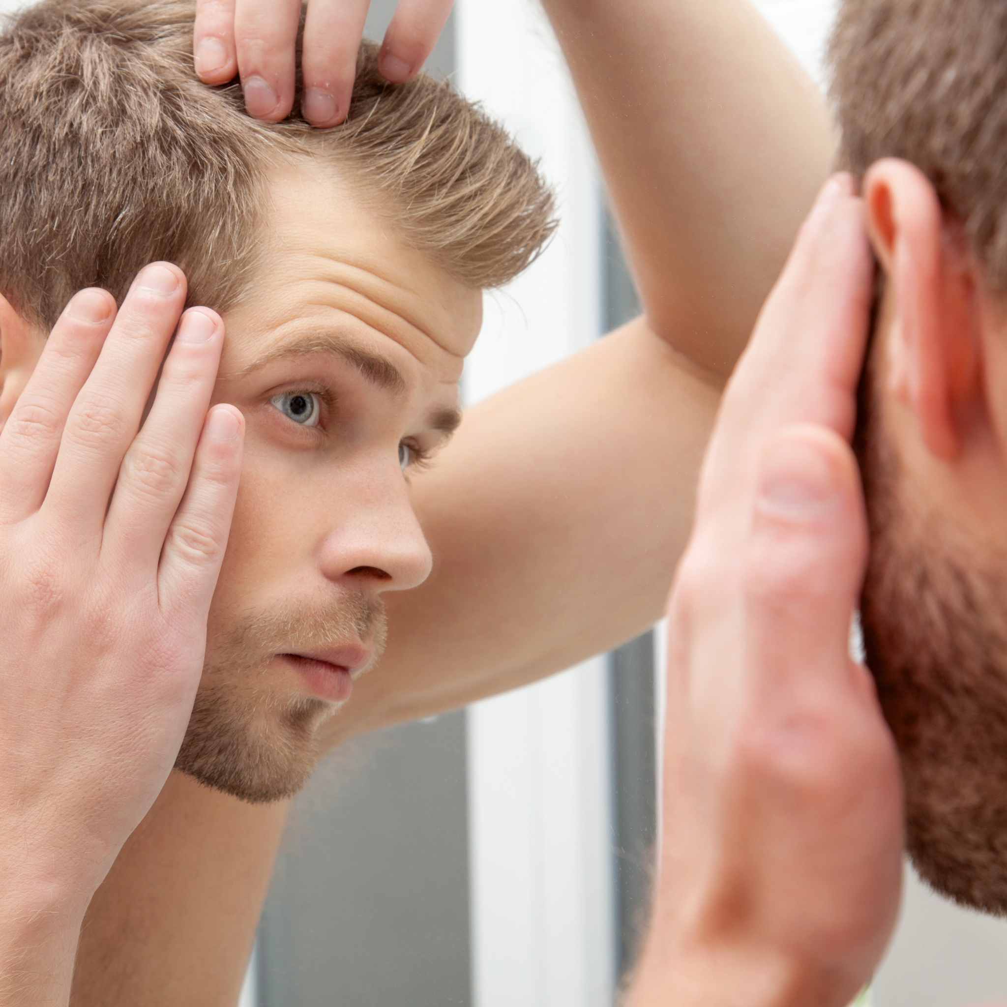 Hair Loss Symtoms - Causes, Signs & Problems of Pattern Baldness