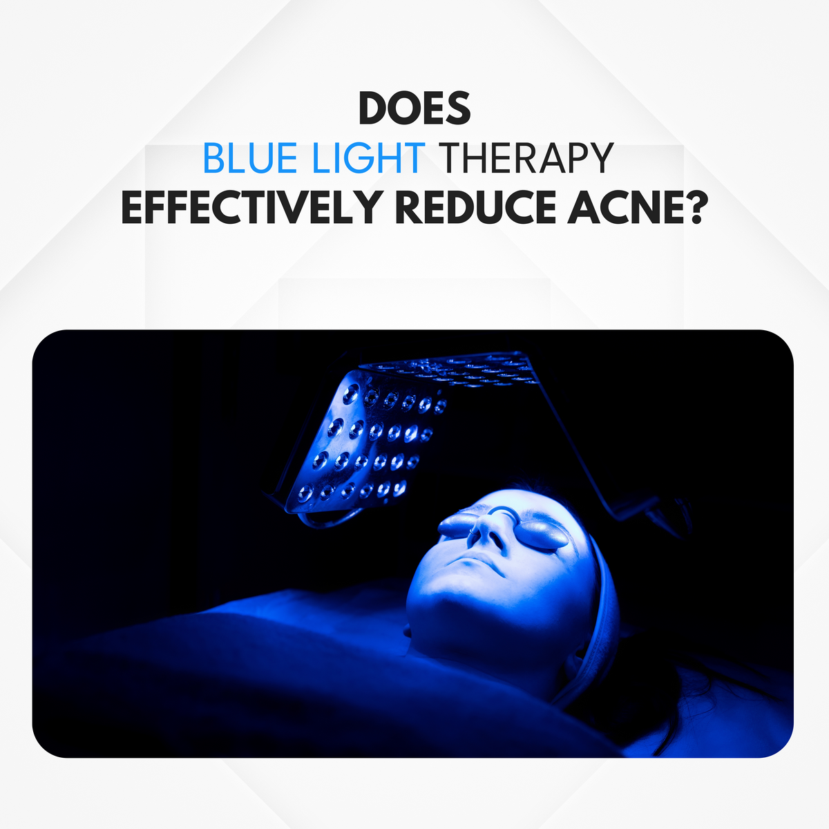 How Effective is Blue Light Therapy for Acne? CHOSEN Store