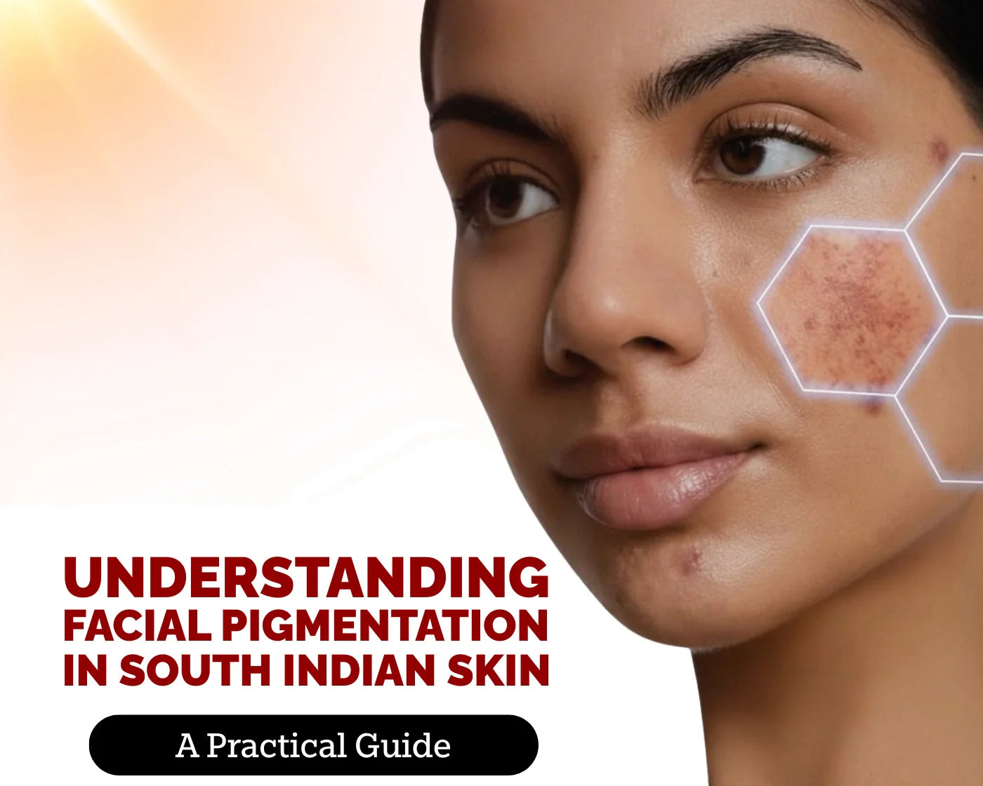 How To Prevent and Treat Facial Pigmentation in South Indian Skin?