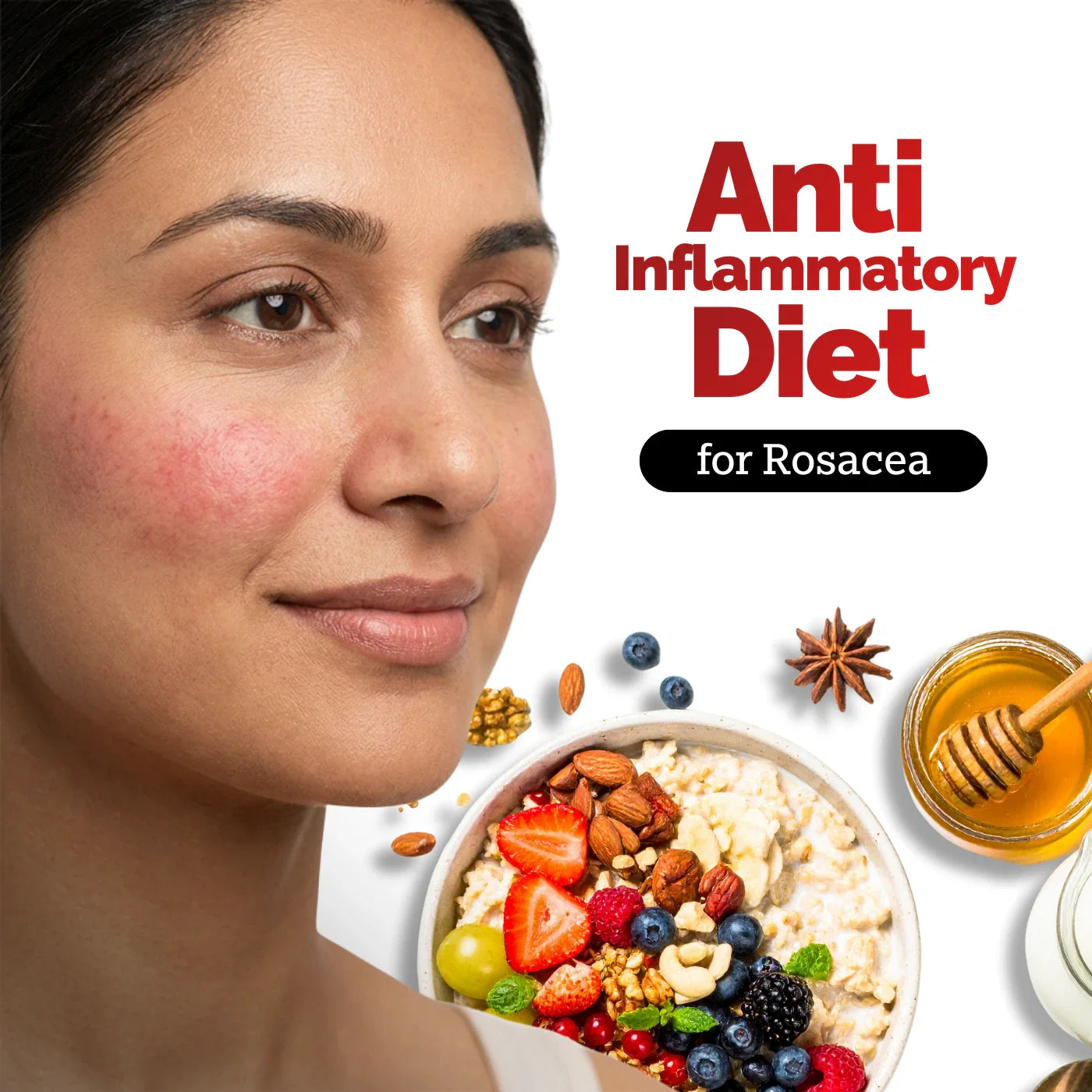 How Your Diet Impacts Rosacea: Science Backed Tips on What to Eat and Avoid