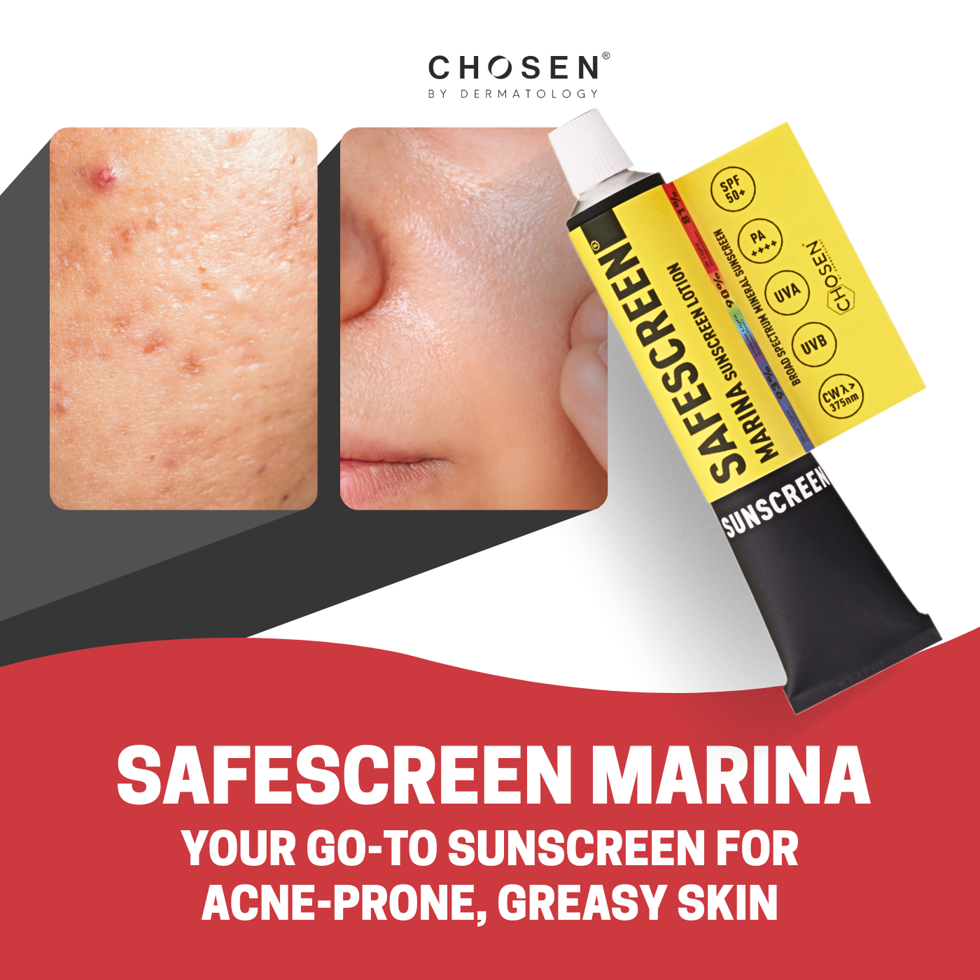 Why SAFESCREEN Marina is the best sunscreen for very oily, acne prone skin in India?