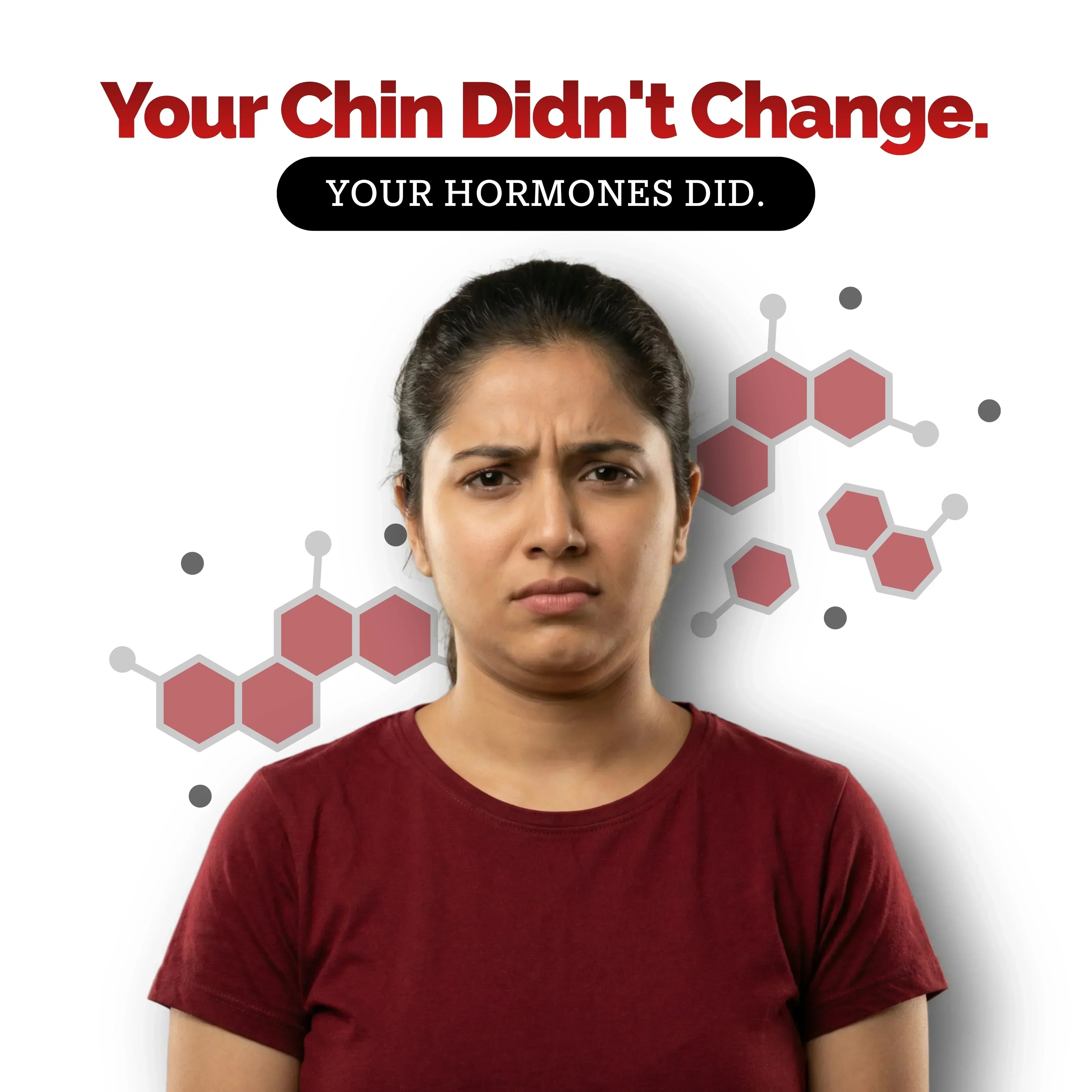 Hormones & Your Jawline: Why Submental Fullness Increases After 35