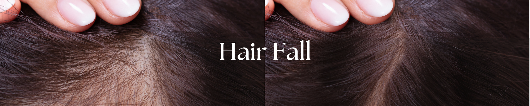 Best Hair Care Products for Female Pattern Hair Fall