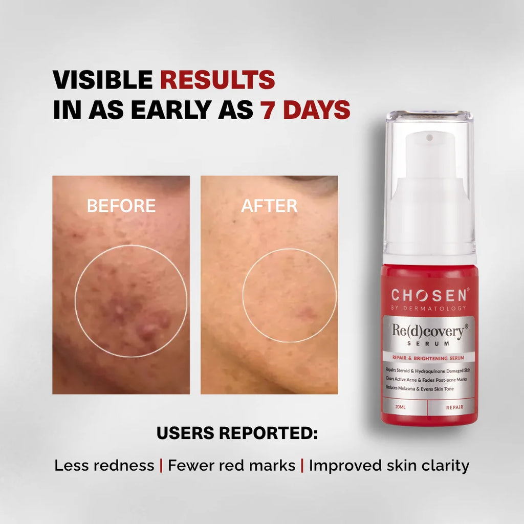 Skincare serum bottle with 'Before' and 'After' skin comparison on a gray background