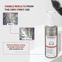 Pinedruff™ Scalp Serum