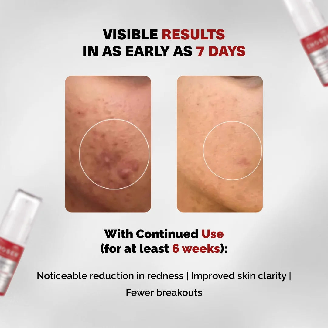 Before and after skin comparison with visible results in 7 days and continued use benefits.