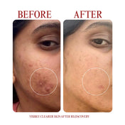 Re(d)covery® Serum
