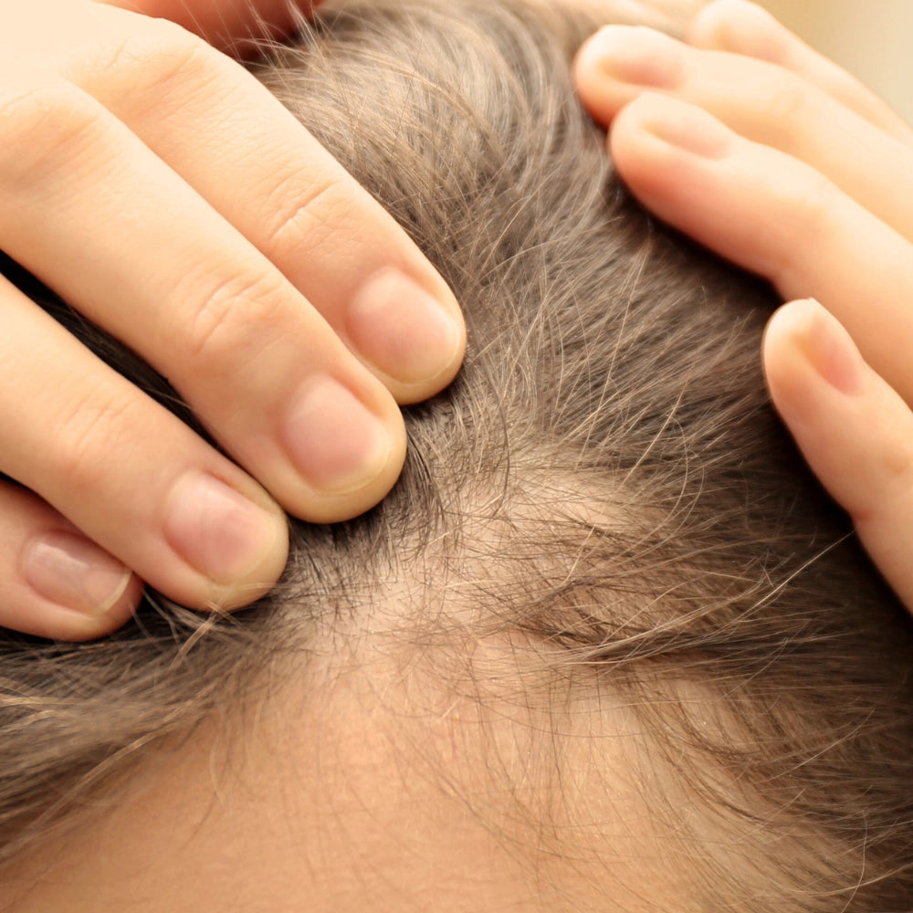 hair-loss-concern