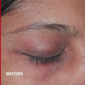 Retinolite™ Pycno Undereye Gel
