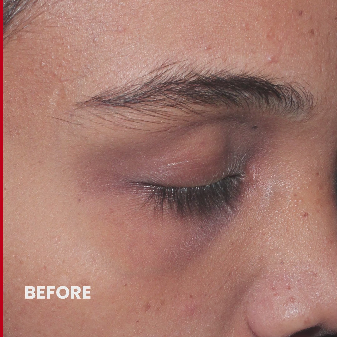 Retinolite™ Pycno Undereye Gel