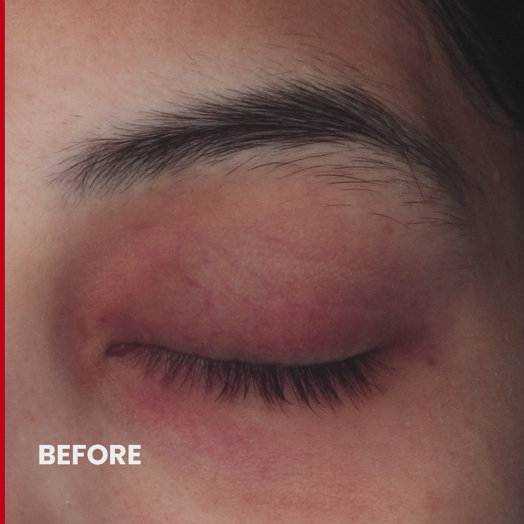 Retinolite™ Pycno Undereye Gel
